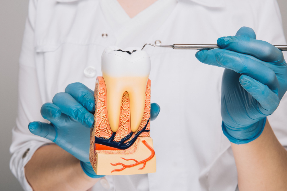 Root Canal Treatment